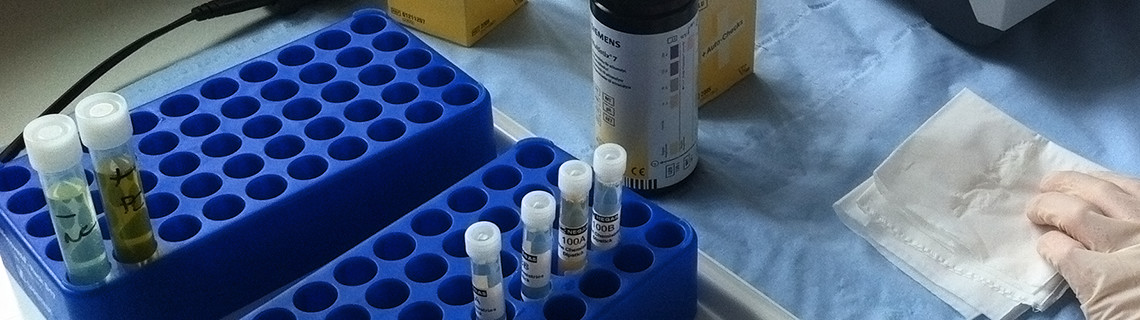 Photo of Dipstick Specimen prep