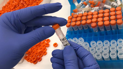 Photo of specimen prep for HIC